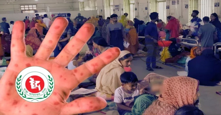 হামে ২৮ দিনে ১৬৯ শিশুর মৃত্যু