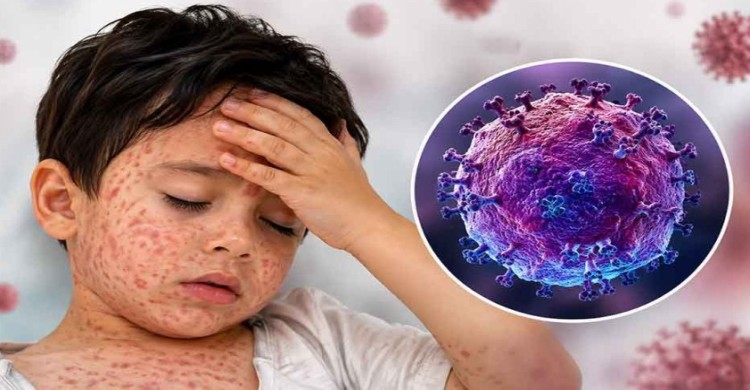 হামে মৃত্যু হাজার ছুঁইছুঁই